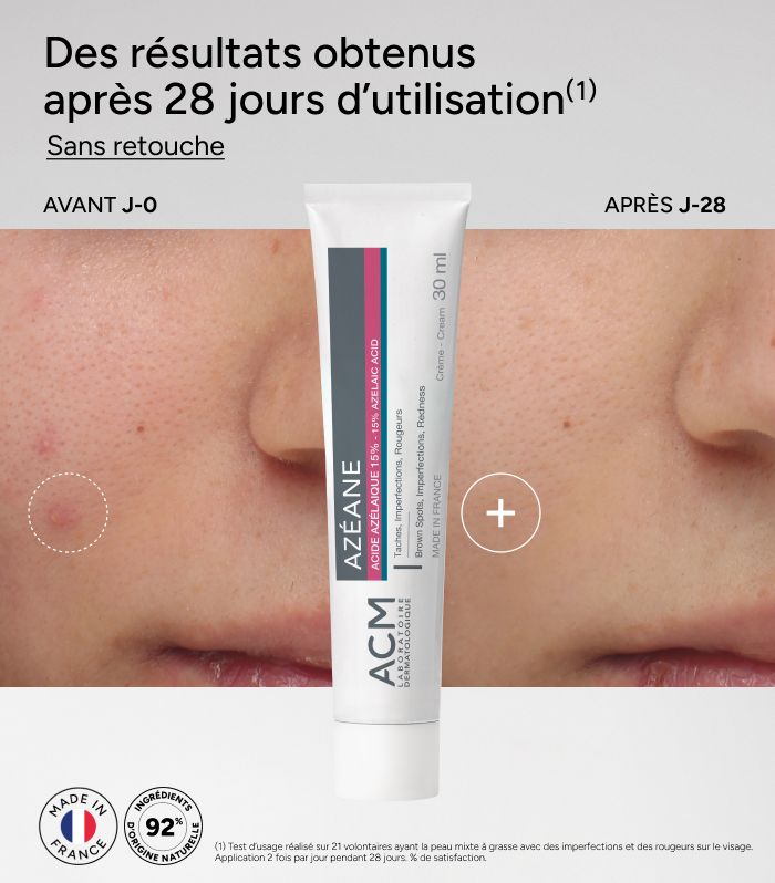 ACM Azéane Cream is a skincare product featuring a 15% azelaic acid concentration. — صورة 2 من 2